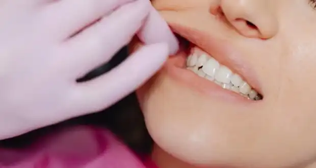 Удаление коренного зуба: почему это не всегда «просто вырвать»